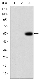 MMP9 / Gelatinase B Antibody - Western blot using MMP9 monoclonal antibody against HEK293 (1), MMP7-hIgGFc transfected HEK293 (2) cell lysate and MMP9-hIgGFc transfected HEK293 (3) cell lysate.