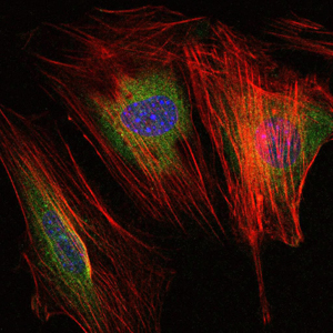 MMP9 / Gelatinase B Antibody - Immunofluorescence of NIH/3T3 cells using MMP9 mouse monoclonal antibody (green). Blue: DRAQ5 fluorescent DNA dye. Red: Actin filaments have been labeled with Alexa Fluor-555 phalloidin.