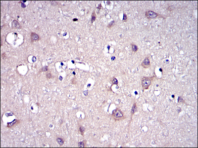 MMP9 / Gelatinase B Antibody - IHC of paraffin-embedded brain tissues using MMP9 mouse monoclonal antibody with DAB staining.