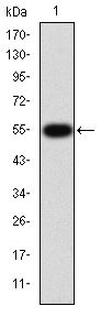 MMP9 / Gelatinase B Antibody - MMP9 Antibody in Western Blot (WB)