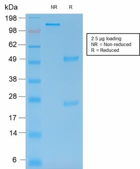 MMP9 / Gelatinase B Antibody - SDS-PAGE Analysis Purified MMP9 Mouse Recombinant Monoclonal Antibody (rMMP9/1769). Confirmation of Integrity of Purity of Antibody.