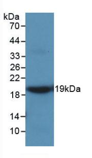 MMP9 / Gelatinase B Antibody