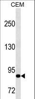 MMP9 / Gelatinase B Antibody - MMP9 Antibody western blot of CEM cell line lysates (35 ug/lane). The MMP9 antibody detected the MMP9 protein (arrow).