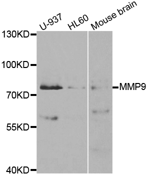 MMP9 / Gelatinase B Antibody - Western blot analysis of extracts of various cell lines.