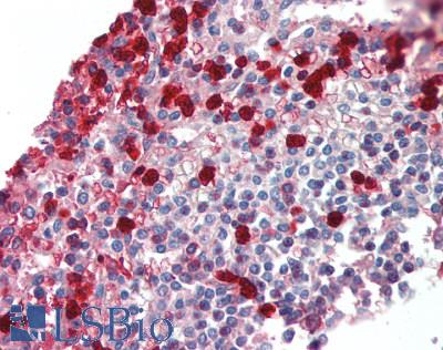 MMP9 / Gelatinase B Antibody - Human Spleen: Formalin-Fixed, Paraffin-Embedded (FFPE)