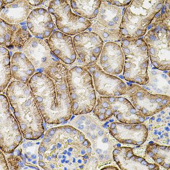MMP9 / Gelatinase B Antibody - Immunohistochemistry of paraffin-embedded mouse kidney using MMP9 antibody at dilution of 1:100 (40x lens).