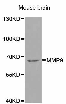 MMP9 / Gelatinase B Antibody - Western blot analysis of extracts of mouse brain, using MMP9 antibody at 1:1000 dilution. The secondary antibody used was an HRP Goat Anti-Rabbit IgG (H+L) at 1:10000 dilution. Lysates were loaded 25ug per lane and 3% nonfat dry milk in TBST was used for blocking. An ECL Kit was used for detection and the exposure time was 90s.