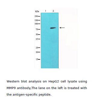 MMP9 / Gelatinase B Antibody - Western blot analysis of MMP-9 expression in HepG2 cells. The lane on the left is treated with the antigen-specific peptide.