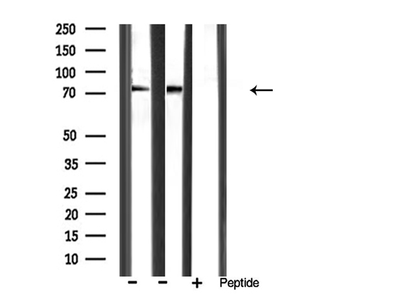 MMP9 / Gelatinase B Antibody - Western blot analysis of extracts of various sample using MMP-9 antibody.