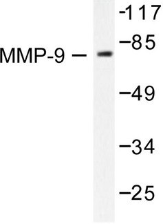 MMP9 / Gelatinase B Antibody - Western blot of MMP-9 (W680) pAb in extracts from HepG2 cells.