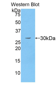 MMRN1 Antibody - Western blot of recombinant MMRN1.  This image was taken for the unconjugated form of this product. Other forms have not been tested.