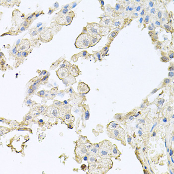 MMRN1 Antibody - Immunohistochemistry of paraffin-embedded human lung tissue.