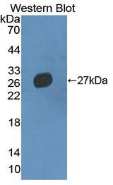MMRN2 / Emilin 3 / EndoGlyx-1 Antibody - Western blot of MMRN2 / Emilin 3 / EndoGlyx-1 antibody.