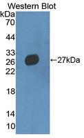 MMRN2 / Emilin 3 / EndoGlyx-1 Antibody - Western blot of MMRN2 / Emilin 3 / EndoGlyx-1 antibody.