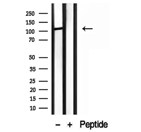 MMS19 Antibody - Western blot analysis of extracts of mouse testis tissue using MMS19 antibody.