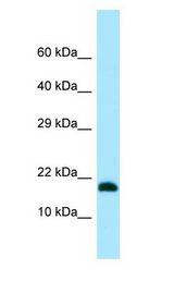 MMS2 / UBE2V2 Antibody - MMS2 / UBE2V2 antibody Western Blot of 721_B.  This image was taken for the unconjugated form of this product. Other forms have not been tested.