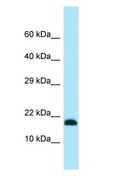 MMS2 / UBE2V2 Antibody - MMS2 / UBE2V2 antibody Western Blot of 721_B.  This image was taken for the unconjugated form of this product. Other forms have not been tested.