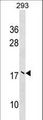 MMS2 / UBE2V2 Antibody - UBE2V2 Antibody western blot of 293 cell line lysates (35 ug/lane). The UBE2V2 antibody detected the UBE2V2 protein (arrow).