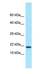 MMS2 / UBE2V2 Antibody - MMS2 / UBE2V2 antibody Western Blot of Fetal Heart.  This image was taken for the unconjugated form of this product. Other forms have not been tested.