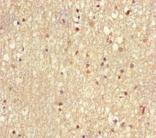 MMS2 / UBE2V2 Antibody - Immunohistochemistry of paraffin-embedded human brain tissue using UBE2V2 Antibody at dilution of 1:100