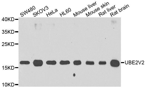 MMS2 / UBE2V2 Antibody - Western blot of extracts of various cell lines, using UBE2V2 antibody.