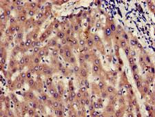 MMS2 / UBE2V2 Antibody - Immunohistochemistry of paraffin-embedded human liver tissue at dilution of 1:100