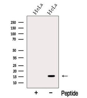 MMS2 / UBE2V2 Antibody - Western blot analysis of extracts of HeLa cells using MMS2 antibody. The lane on the left was treated with blocking peptide.