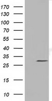 MMS21 / NSMCE2 Antibody - HEK293T cells were transfected with the pCMV6-ENTRY control (Left lane) or pCMV6-ENTRY NSMCE2 (Right lane) cDNA for 48 hrs and lysed. Equivalent amounts of cell lysates (5 ug per lane) were separated by SDS-PAGE and immunoblotted with anti-NSMCE2.