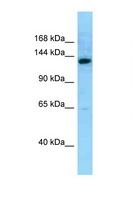MN1 Antibody - MN1 antibody Western blot of Fetal Liver lysate. Antibody concentration 1 ug/ml.  This image was taken for the unconjugated form of this product. Other forms have not been tested.