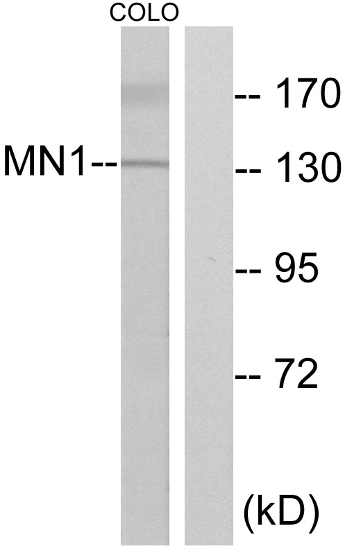 MN1 Antibody - Western blot analysis of lysates from COLO cells, using MN1 Antibody. The lane on the right is blocked with the synthesized peptide.