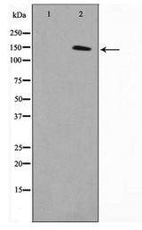 MN1 Antibody - Western blot of COLO205 cell lysate using MN1 Antibody