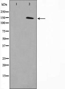 MN1 Antibody - Western blot analysis on COLO205 cell lysates using MN1 antibody. The lane on the left is treated with the antigen-specific peptide.