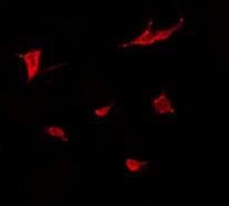 MN1 Antibody - Staining COLO205 cells by IF/ICC. The samples were fixed with PFA and permeabilized in 0.1% Triton X-100, then blocked in 10% serum for 45 min at 25°C. The primary antibody was diluted at 1:200 and incubated with the sample for 1 hour at 37°C. An Alexa Fluor 594 conjugated goat anti-rabbit IgG (H+L) Ab, diluted at 1/600, was used as the secondary antibody.