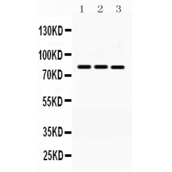 MNAT1 Antibody - MNAT1 antibody Western blot. All lanes: Anti MNAT1 at 0.5 ug/ml. Lane 1: Rat Brain Tissue Lysate at 50 ug. Lane 2: Rat Liver Tissue Lysate at 50 ug. Lane 3: MCF-7 Whole Cell Lysate at 40 ug. Lane 4: HELA Whole Cell Lysate at 40 ug. Predicted band size: 81 kD. Observed band size: 81 kD.