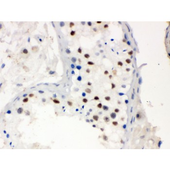 MNAT1 Antibody - MNAT1 antibody IHC-paraffin. IHC(P): Human Testis Tissue.