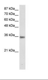 MNAT1 Antibody - Jurkat Cell Lysate.  This image was taken for the unconjugated form of this product. Other forms have not been tested.