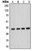 MNAT1 Antibody - Western blot analysis of MNAT1 expression in HeLa (A); MCF7 (B); A431 (C); NIH3T3 (D) whole cell lysates.