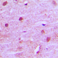 MNAT1 Antibody - Immunohistochemical analysis of MNAT1 staining in human brain formalin fixed paraffin embedded tissue section. The section was pre-treated using heat mediated antigen retrieval with sodium citrate buffer (pH 6.0). The section was then incubated with the antibody at room temperature and detected using an HRP conjugated compact polymer system. DAB was used as the chromogen. The section was then counterstained with hematoxylin and mounted with DPX.