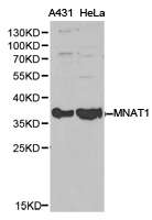 MNAT1 Antibody - Western blot of extracts of various cell lines, using MNAT1 antibody.