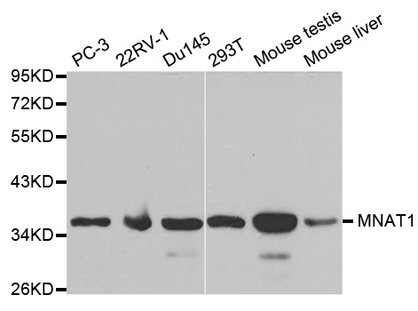 MNAT1 Antibody - Western blot analysis of extracts of various cell lines.