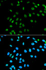 MNAT1 Antibody - Immunofluorescence analysis of MCF7 cells.