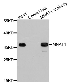 MNAT1 Antibody - Immunoprecipitation analysis of 200ug extracts of 293T cells.