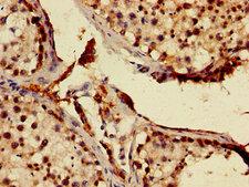 MNAT1 Antibody - Immunohistochemistry image of paraffin-embedded human testis tissue at a dilution of 1:100