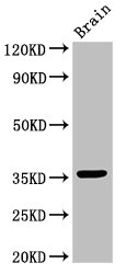 MNAT1 Antibody - Positive Western Blot detected in Mouse brain tissue. All lanes: MNAT1 antibody at 3 µg/ml Secondary Goat polyclonal to rabbit IgG at 1/50000 dilution. Predicted band size: 36, 32 KDa. Observed band size: 36 KDa