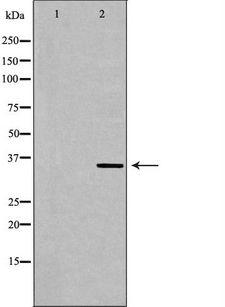 MNAT1 Antibody - Western blot analysis of HeLa whole cells lysates using MNAT1 antibody. The lane on the left is treated with the antigen-specific peptide.