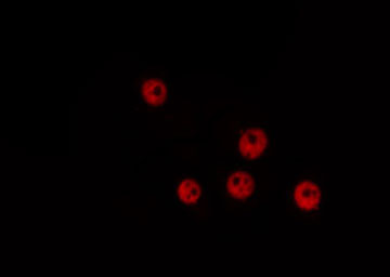 MNAT1 Antibody - Staining HeLa cells by IF/ICC. The samples were fixed with PFA and permeabilized in 0.1% Triton X-100, then blocked in 10% serum for 45 min at 25°C. The primary antibody was diluted at 1:200 and incubated with the sample for 1 hour at 37°C. An Alexa Fluor 594 conjugated goat anti-rabbit IgG (H+L) Ab, diluted at 1/600, was used as the secondary antibody.