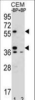 MNDA Antibody - Western blot of MNDA Antibody antibody pre-incubated without(lane 1) and with(lane 2) blocking peptide in CEM cell line lysate. MNDA Antibody (arrow) was detected using the purified antibody.