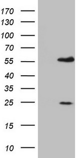 MNDA Antibody - HEK293T cells were transfected with the pCMV6-ENTRY control. (Left lane) or pCMV6-ENTRY MNDA. (Right lane) cDNA for 48 hrs and lysed. Equivalent amounts of cell lysates. (5 ug per lane) were separated by SDS-PAGE and immunoblotted with anti-MNDA.