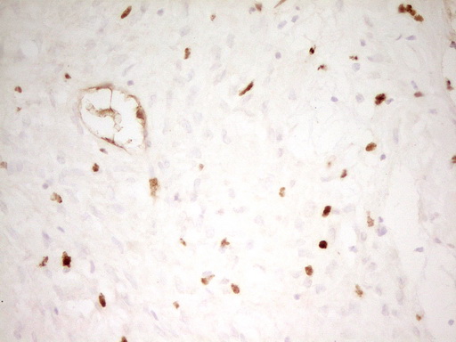 MNDA Antibody - Immunohistochemical staining of paraffin-embedded Human Ovary tissue within the normal limits using anti-MNDA mouse monoclonal antibody. (Heat-induced epitope retrieval by 1 mM EDTA in 10mM Tris, pH8.5, 120C for 3min,