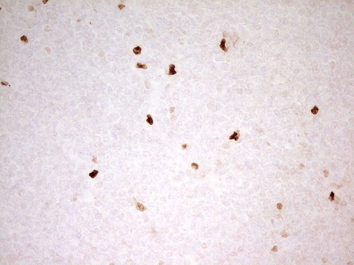 MNDA Antibody - Immunohistochemical staining of paraffin-embedded Human tonsil within the normal limits using anti-MNDA mouse monoclonal antibody. (Heat-induced epitope retrieval by 1 mM EDTA in 10mM Tris, pH8.5, 120C for 3min,